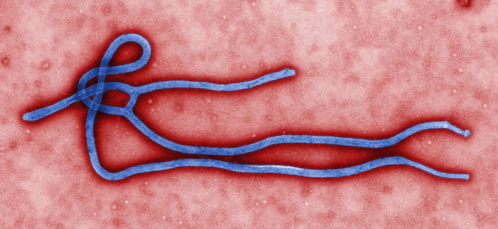 Colorized transmission electron micrograph of an Ebola virus virion, showing the characteristic filamentous, branching structure shared by all Ebola species